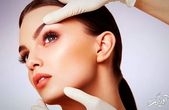 ماندگاری اندولیفت